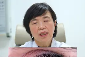 眼睛出现红血丝，5个常见原因！ #红血丝 #干眼症 #眼科教授晏晓明 @抖音热点 @抖音短视频视频封面