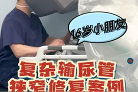 输尿管狭窄的治疗需要根据具体情况而定,其中先天性肾盂输尿管连接部的狭窄,修复手术是首选的金标准#输尿管狭窄 #肾积水 #先天性肾盂输尿管连接部狭窄 #硬核健康科普行动  #健康冷知识知多少视频封面