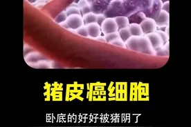 猪基因病毒做成抗癌导弹 癌细胞顶贴猪标签被免疫系统全歼 #癌症 #癌细胞 #医疗 #猪皮 #癌症治疗视频封面