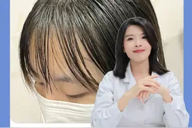 早上刚洗完头晚上就又油又塌？医生一招教来控油！#头油 #洗发水 #油头 #头发