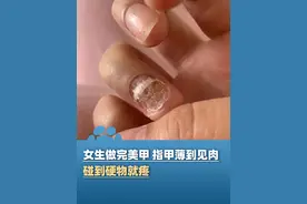 1月23日（报道）江苏南京，女生做完美甲后指甲薄到见肉 碰到硬物就疼，医生：如果美甲工具没有严格消毒，也可能造成HPV病毒感染#美甲视频封面