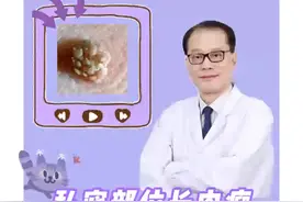 私密部位长肉瘤，应该怎么处理？
#hpv #尖锐湿疣 #鬼臼毒素酊 #硬核健康科普行动视频封面