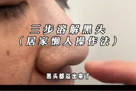 居家懒人三步去黑头，自己在家动手学起来（建议吃完饭后再看~） #护肤 #黑头粉刺 #闭口粉刺视频封面