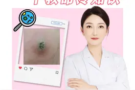 脚底长黄色的硬疙瘩，不要再当作鸡眼处理 #硬核健康科普行动 #2025健康许愿池 #跖疣视频封面