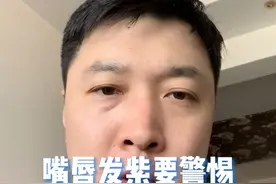 嘴唇发紫要警惕#嘴唇发紫 #嘴唇发紫发黑是什么原因 #每天一个评论区问题回复