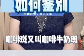 儿童咖啡斑与神经纤维瘤病如何鉴别#咖啡斑 #神经纤维瘤 #北京儿童医院 #邢嬛 #医学科普视频封面