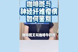 儿童咖啡斑与神经纤维瘤病如何鉴别#咖啡斑 #神经纤维瘤 #北京儿童医院 #邢嬛 #医学科普视频封面