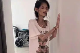 “我想活下去！”27岁女孩患胃萎缩发视频求助，体重从90多斤暴瘦至35斤