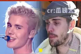 贾斯汀・比伯状况堪忧，到底经历了什么？#贾斯丁比伯 #流浪汉 #突然衰老 
