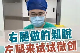 山东大姐右腿在当地做的剥脱手术，这次左腿来找我们做微创。#静脉曲张 #静脉曲张彭军路主任 #医大一院静脉曲张微创诊疗中心#抖出健康知识宝藏 #开工去班味健康指南视频封面