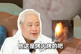 天气再冷，烤火也别太近啦！ #科普 #网状红斑 #烤火 #烤火取暖 #冬天