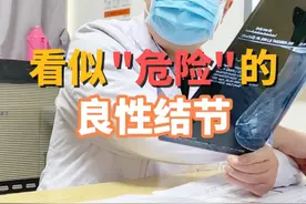 看似"危险"的良性结节 乳腺钼靶钙化好大一个，看着吓人实际上不然，不要自己吓自己#乳腺 #医学科普 #女性#乳腺外科刘锦平 @抖音短视频 #抖音知识年终大赏视频封面