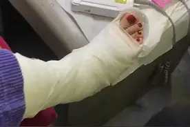 4月24日，北京，女子脚骨裂打着石膏坐轮椅，坚持给做脚部做美甲视频封面