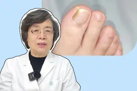 指甲变空、增厚、一剪就碎，都是灰指甲的典型表现，这个病越拖越严重，一定要及时处理！#灰指甲 #传染 #医学科普 #灰指甲初期的照片 #灰指甲专用药