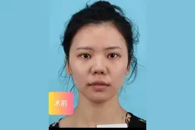 六种天生“穷”相，目光短浅能力低，一生劳苦难富贵！ #看相视频封面