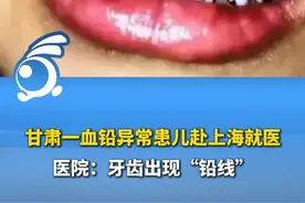 甘肃一血铅异常患儿赴上海就医，医院：牙齿出现“铅线”。 