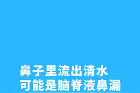 鼻子里流出清水，可能是脑脊液鼻漏，采取鼻腔漏补手术，术后鼻子不再流水#脑脊液视频封面