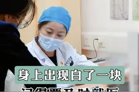 身上出现白斑，要注意了#医学科普 #白斑 #白癜风 #硬核健康科普行动  #知识分享视频封面