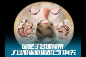 子宫脱垂原来跟这些韧带有关 #解剖学 #医学生 #子宫脱垂