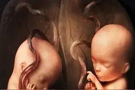 双胞胎是如何形成的，龙凤胎的形成到底有多神奇？ #双胞胎#生命科学  #新生儿的诞生过程奇妙的生命 #科普 #涨知识视频封面