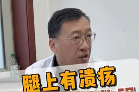 腿上有溃疡，是咱们静脉曲张造成的，不是你的白癜风引发的。所以咱们治疗了静脉曲张后溃疡就慢慢恢复了。#马云龙主任  #静脉曲张微创  #静脉曲张#抖出健康知识宝藏视频封面
