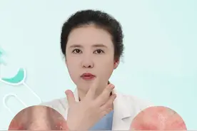 鼻翼处总是泛红、脱皮怎么办？ #脂溢性皮炎 #鼻翼泛红 #医疗创作者培优计划 #硬核健康科普行动视频封面