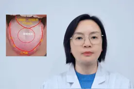 这个舌头，上焦有火，中焦有湿，下焦气滞，调理难上加难 #中医#舌诊 #辨证 #调理身体视频封面