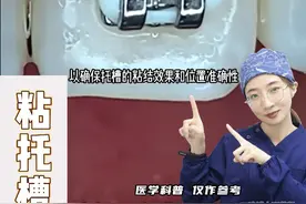 正畸第一步：让小小托槽开启牙齿的“变身计划”！
#牙齿矫正 #正畸矫正 #托槽矫正 #一口好牙