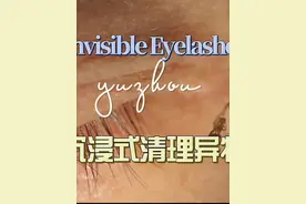 沉浸式清理眼睛异物，无解说纯享版~ 眼睛不舒服及时就医视频封面