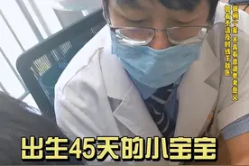 新生儿头型异常要注意#颅缝早闭视频封面
