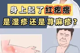 身上起了红疙瘩是湿疹还是荨麻疹？ #皮肤问题视频封面