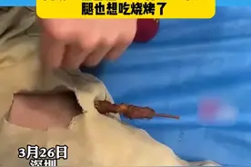 男子吃烧烤不慎被竹签扎腿：难道是腿也想吃烧烤了？#烧烤 #哈哈哈哈哈哈我要笑死了视频封面