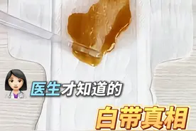 医生教你30s自查白带，这才是女生的必修课！#白带#女性#女性健康#女生必看#硬核健康科普行动视频封面