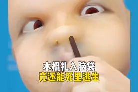 木棍扎入脑袋 竟还能死里逃生 #科普 #科普一下 #涨知识 #放屁视频封面