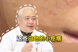 脸上的三种痘痘，一个视频教你处理！ #痘痘 #科普 #医学科普 #涨知识 #健康视频封面