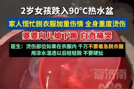 4月5日报道，河南郑州。2岁女童跌进热水盆全身重度烫伤 医生提醒：烫伤后硬扯衣服会二次损伤，就医路上可采取降温措施#扩散周知 #父母必看系列#健康守护计划 #科普一下 #热门推荐