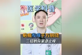 疤痕发痒千万别挠，三招教你紧急止痒！ #疤痕 #疤痕增生 #疤痕疙瘩 #瘢痕修复 #抖出健康知识宝藏