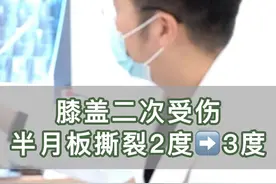 打篮球膝盖二次扭伤，前交叉韧带断裂，半月板损伤加重到3级 #半月板损伤 #前交叉韧带重建#膝盖保护  #医学科普 #远离伤病视频封面