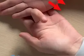 2月25日报道，通则不痛，痛则不通！“勾手指”其实是个养生动作，中医：感觉痛说明身体有淤堵，每天3组一次30次视频封面