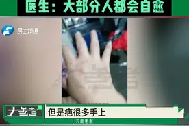多地出现“登革热”病例，传播途径竟是蚊子，症状：高烧、皮疹，医生：大部分人都会自愈#常识中国视频封面
