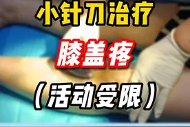 膝盖痛 蹲起困难 你是不是也有这个问题？#中医 #小针刀 #膝盖疼 #蹲起困难 #医者仁心视频封面