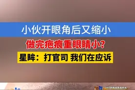 小伙开眼角后又缩小，做完疤痕重眼睛小？星眸：打官司 我们在应诉#浙江dou知道 #媒体精选计划