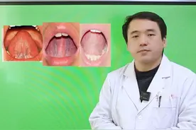 千万别忘了，舌诊除了看舌色舌神，舌形百态，还有重要一环，舌脉！#舌诊 #舌象 #中医科普 #健康科普 #涨知识视频封面