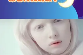 白化病，来自月亮的孩子#白化病 #白化病女孩 @抖音短视频