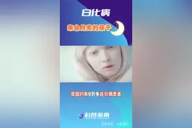 白化病，来自月亮的孩子#白化病 #白化病女孩 @抖音短视频