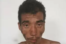 周口项城寻亲：青年男子被救助，上身赤裸，穿黑色裤子图片