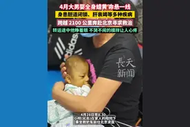 4月大男婴全身蜡黄、命悬一线，身患胆道闭锁、肝衰竭等多种疾病，跨越 2100 公里奔赴北京寻求救治。转运途中他睁着眼，不哭不闹的模样让人心疼。#广西小黄人千里转运北京  #广西小明千里转运换肝  #广西4月大婴儿小明转运北京  #广西“小黄人”