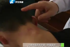 4月4日河南郑州，孩子感冒发烧，家长干着急？在家可以找找孩子脖子后的“大椎穴”降温。“低头，找脖子后面最高骨头后的凹陷”#中国节气清明篇