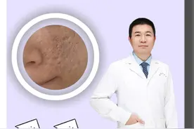 痘印比痘痘还难祛？教你这样快速处理#痘痘 #痘印 #痘坑 #医用痤疮防疤贴