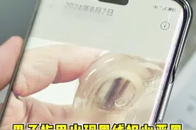 男子指甲出现黑线担心恶黑 未做病理直接截肢 #肿瘤免疫博士汪治宇 #恶性黑色素瘤 #门诊故事 @抖音医疗健康小助手视频封面